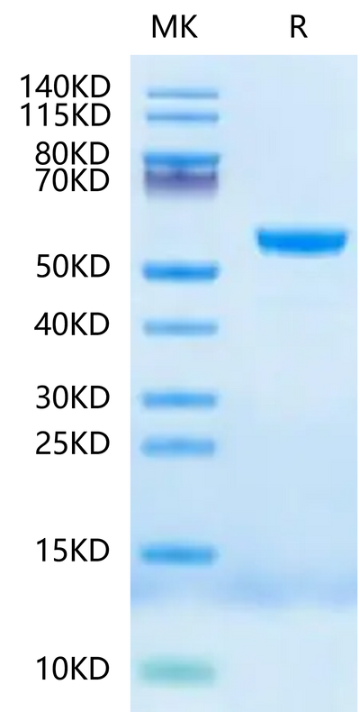 Human HLA-E*01:03&B2M&Peptide (VMAPKTLVL) Monomer Negative Control on Tris-Bis PAGE under reduced condition. The purity is greater than 95%.