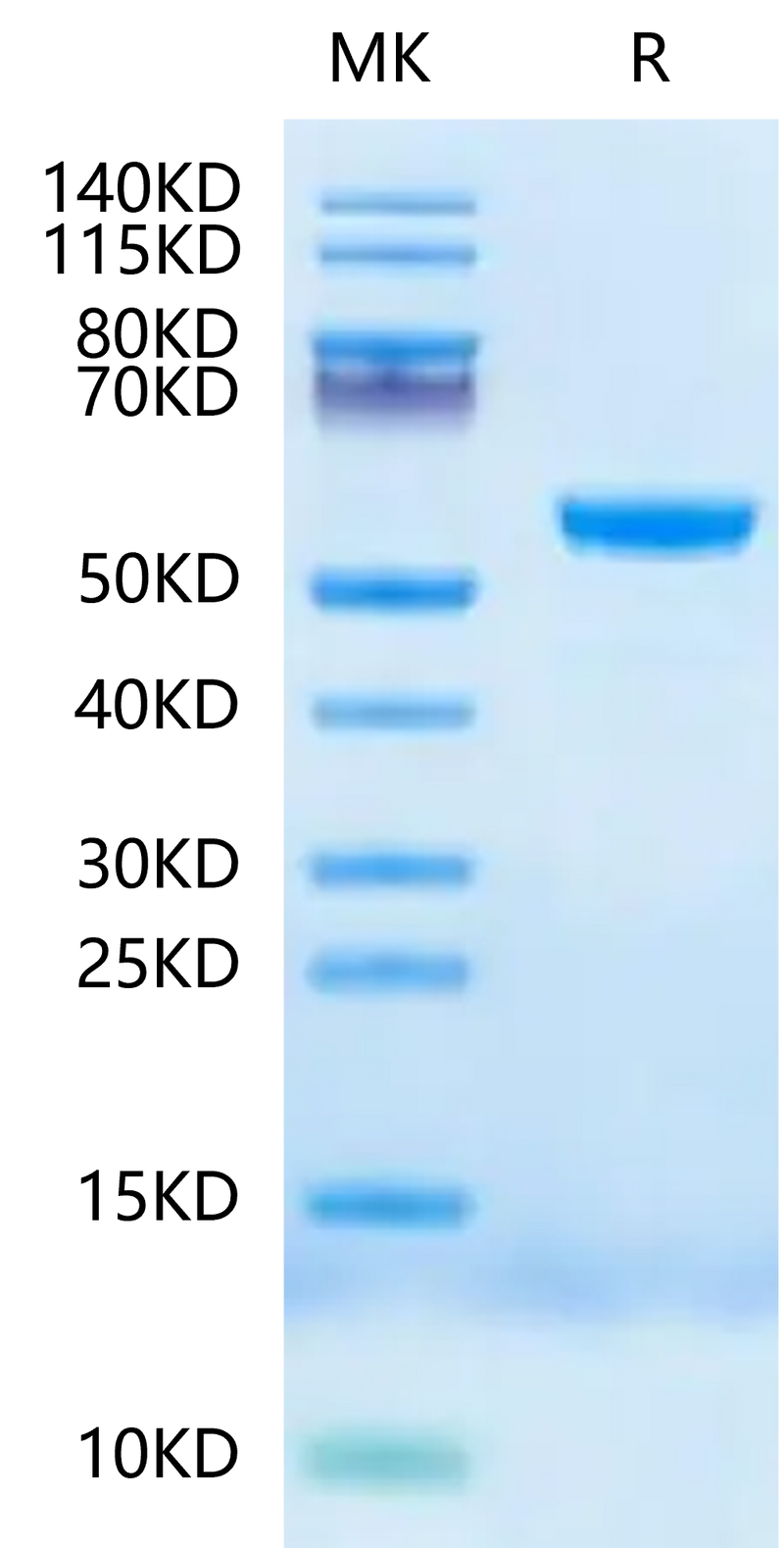 Human HLA-E*01:03&B2M&Peptide (VMAPKTLVL) Monomer Negative Control on Tris-Bis PAGE under reduced condition. The purity is greater than 95%.