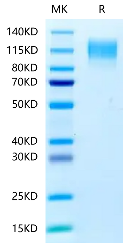 Human CEACAM-5 on Tris-Bis PAGE under reduced condition. The purity is greater than 95%.