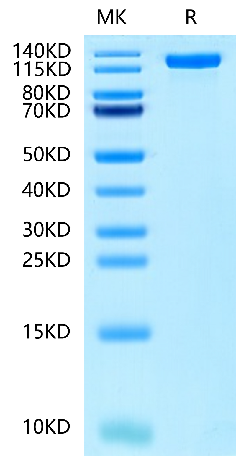 Human EGFR on Tris-Bis PAGE under reduced condition. The purity is greater than 95%.