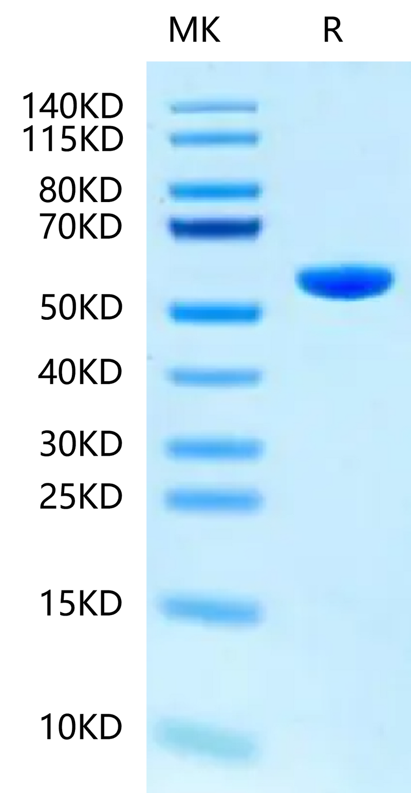 Human HLA-B*15:01&B2M&SARS-CoV-2 epitope (NQKLIANQF) Monomer on Tris-Bis PAGE under reduced condition. The purity is greater than 95%.