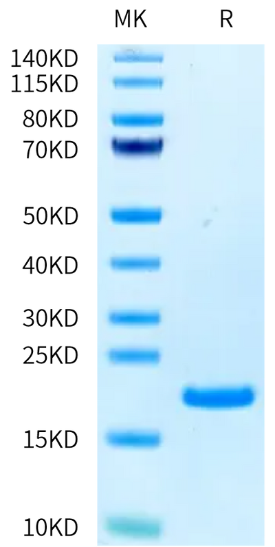 Human CD40 Ligand on Tris-Bis PAGE under reduced condition. The purity is greater than 95%.