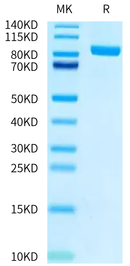 Biotinylated Human FAP on Tris-Bis PAGE under reduced conditions. The purity is greater than 95%.