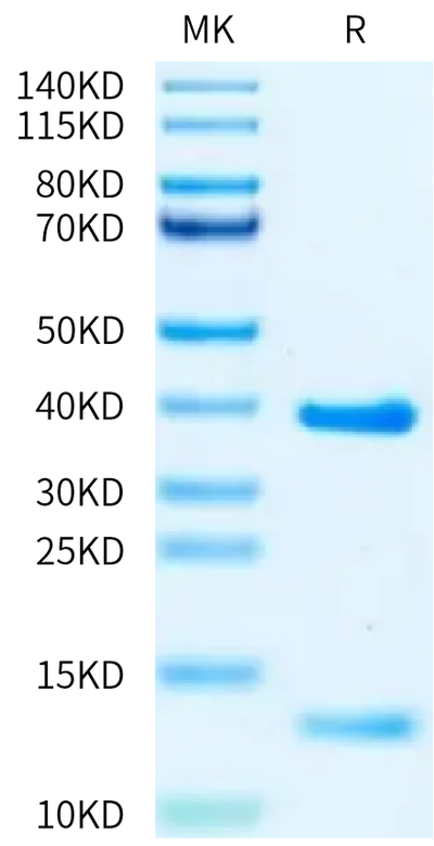 Biotinylated Human HLA-A*02:01&B2M&KRAS G12V (KLVVVGAVGV) Monomer on Tris-Bis PAGE under reduced condition. The purity is greater than 95%.