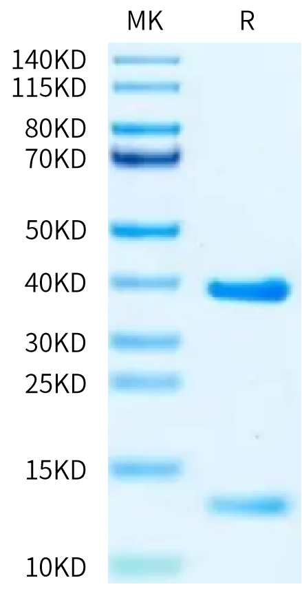 Biotinylated Human HLA-A*02:01&B2M&KRAS G12V (KLVVVGAVGV) Monomer on Tris-Bis PAGE under reduced condition. The purity is greater than 95%.