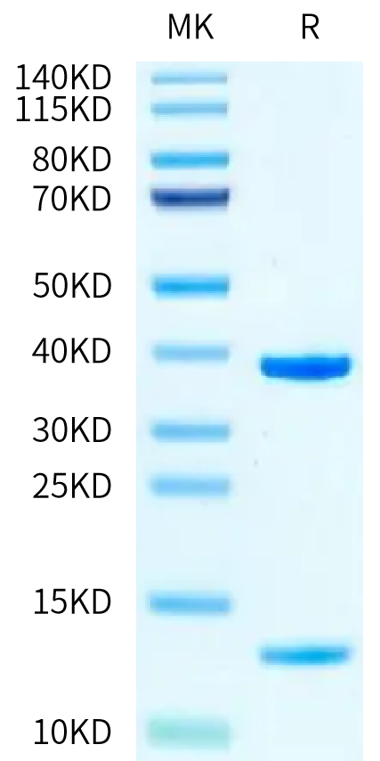 Human HLA-A*11:01&B2M&KRAS G12V (VVVGAVGVGK) Monomer on Tris-Bis PAGE under reduced condition. The purity is greater than 95%.