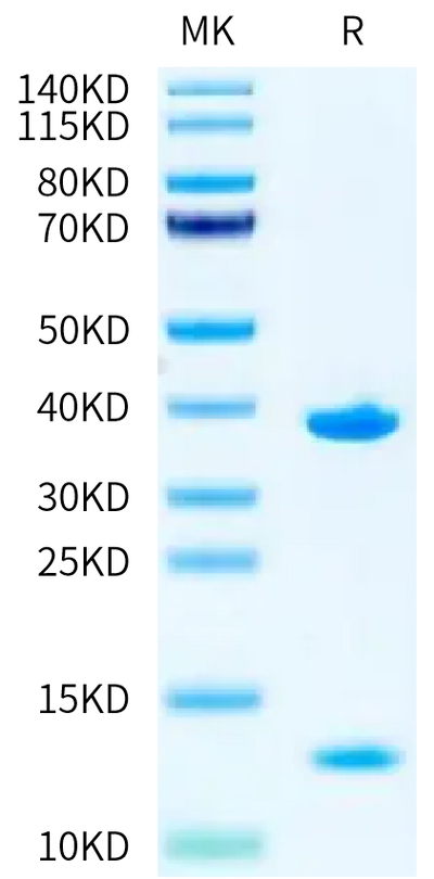 Biotinylated Human HLA-A*11:01&B2M&KRAS G12V (VVVGAVGVGK) Monomer on Tris-Bis PAGE under reduced condition. The purity is greater than 95%.