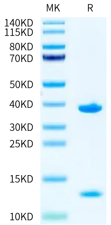 Biotinylated Human HLA-A*11:01&B2M&KRAS G12V (VVVGAVGVGK) Monomer on Tris-Bis PAGE under reduced condition. The purity is greater than 95%.