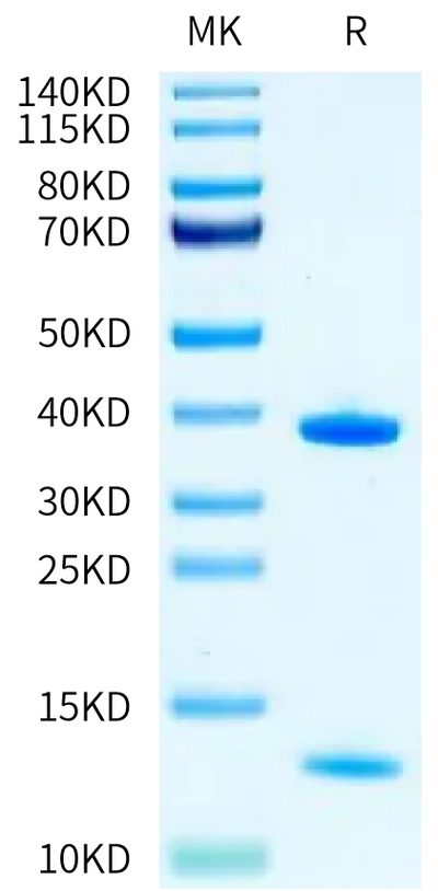 Human HLA-A*11:01&B2M&KRAS G12V (VVGAVGVGK) Monomer on Tris-Bis PAGE under reduced condition. The purity is greater than 95%.