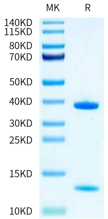 Human HLA-A*11:01&B2M&KRAS G12V (VVGAVGVGK) Monomer on Tris-Bis PAGE under reduced condition. The purity is greater than 95%.