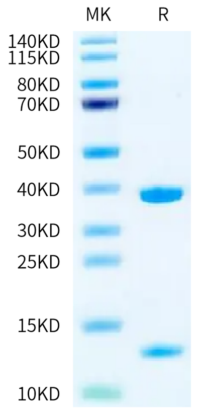 Biotinylated Human HLA-A*11:01&B2M&KRAS G12V (VVGAVGVGK) Monomer on Tris-Bis PAGE under reduced condition. The purity is greater than 95%.