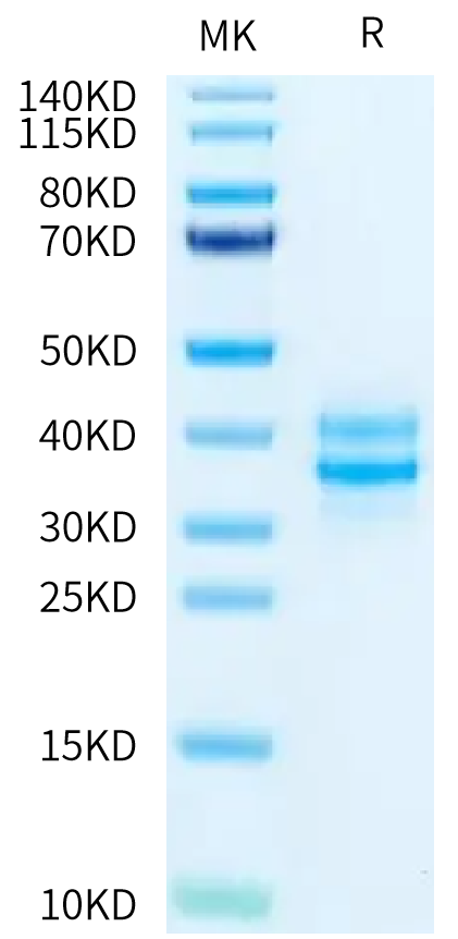 Cynomolgus/Rhesus macaque EpCAM on Tris-Bis PAGE under reduced condition. The purity is greater than 95%.