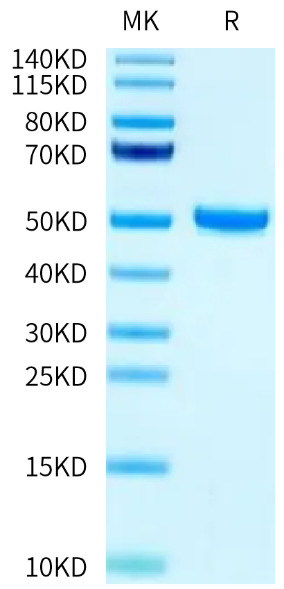 Biotinylated Human FcRn on Tris-Bis PAGE under reduced condition. The purity is greater than 95%.