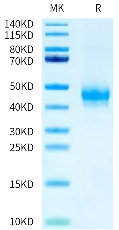 Human Fc gamma RIIIA (V176) Domain 2 Protein on Tris-Bis PAGE under reduced condition. The purity is greater than 95%.