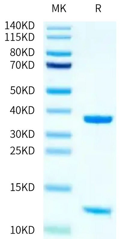 Human HLA-A*11:01&B2M&KRAS WT (VVVGAGGVGK) Monomer on Tris-Bis PAGE under reduced condition. The purity is greater than 95%.