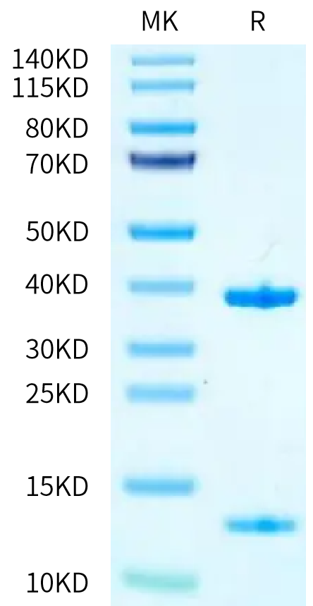 Biotinylated Human HLA-A*11:01&B2M&KRAS WT (VVVGAGGVGK) Monomer on Tris-Bis PAGE under reduced condition. The purity is greater than 95%.