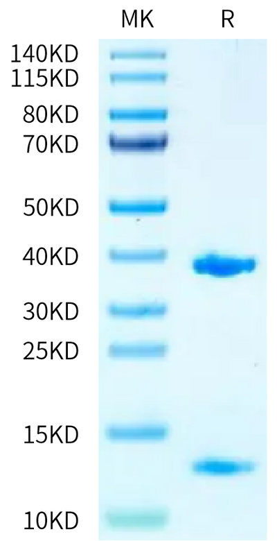 Biotinylated Human HLA-A*11:01&B2M&KRAS WT (VVGAGGVGK) Monomer on Tris-Bis PAGE under reduced condition. The purity is greater than 95%.