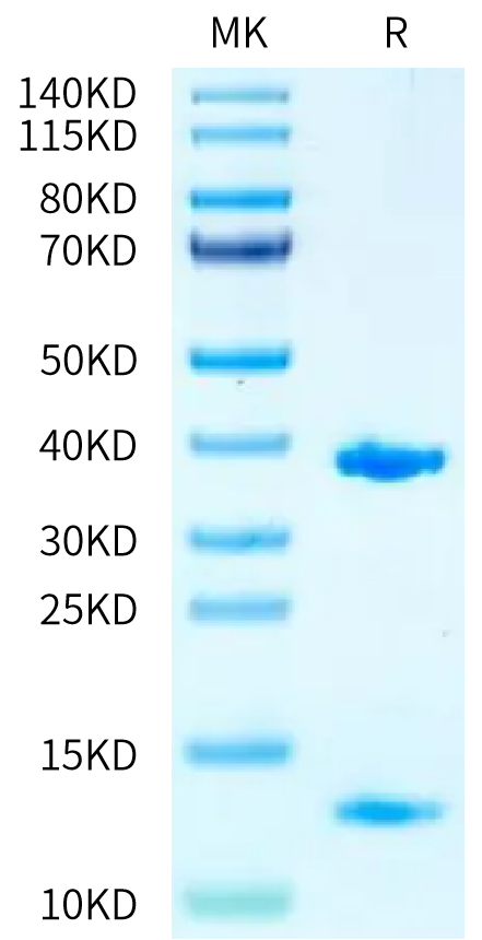 Biotinylated Human HLA-A*11:01&B2M&KRAS WT (VVGAGGVGK) Monomer on Tris-Bis PAGE under reduced condition. The purity is greater than 95%.