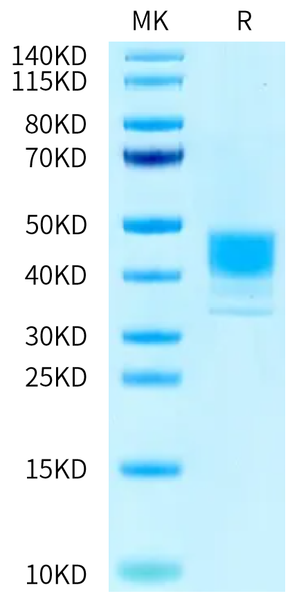 Human MSLN (M593V) on Tris-Bis PAGE under reduced condition. The purity is greater than 95%.