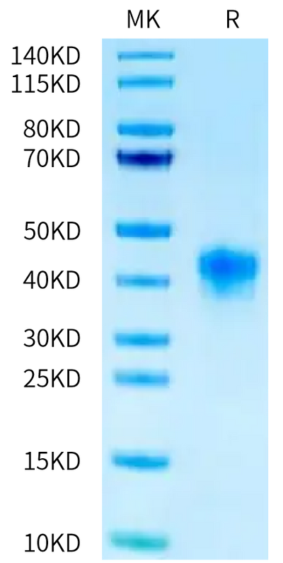 FITC-Labeled Human FOLR1 on Tris-Bis PAGE under reduced condition. The purity is greater than 95%.