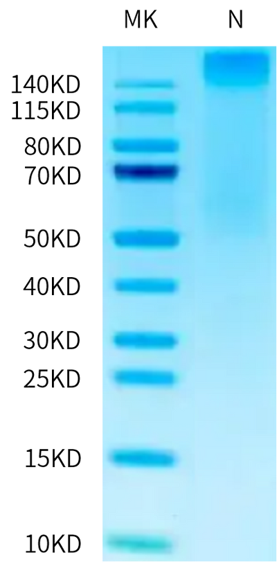 Human HLA-A*02:01&B2M&CMV pp65 (NLVPMVATV) Tetramer on Tris-Bis PAGE under under Non reducing (N) condition. The purity is greater than 95%.