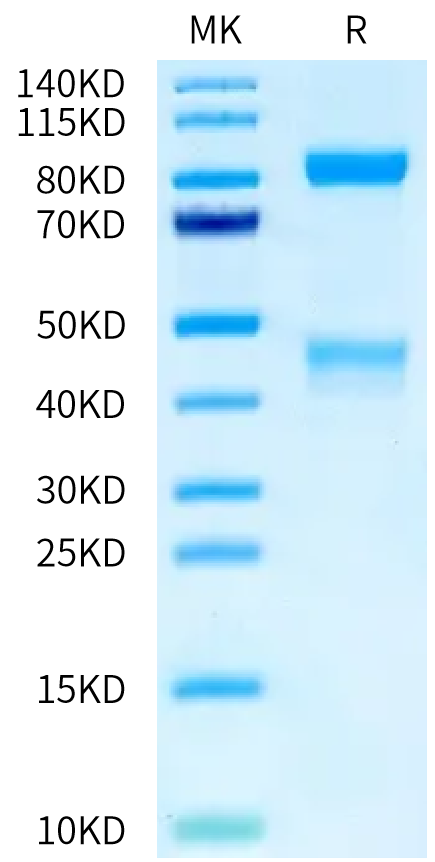 Mouse HGF R on Tris-Bis PAGE under reduced condition. The purity is greater than 95%.