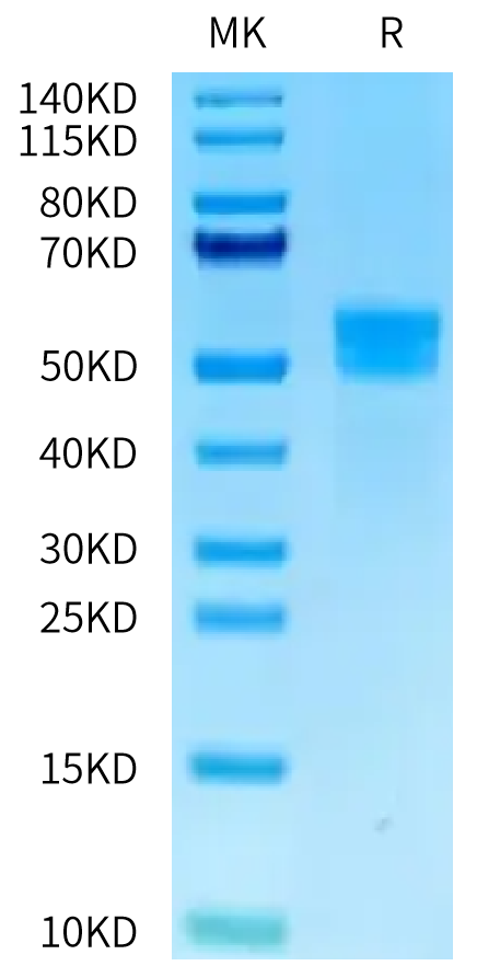 Human MSLN on Tris-Bis PAGE under reduced condition. The purity is greater than 95%.