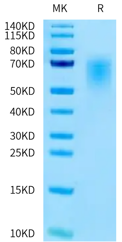 Human CEACAM-5 (145-322) on Tris-Bis PAGE under reduced condition. The purity is greater than 95%.