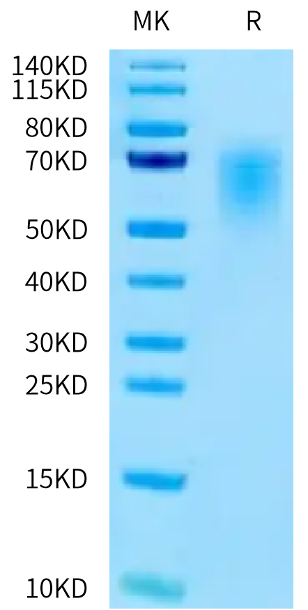 Human CEACAM-5 (145-322) on Tris-Bis PAGE under reduced condition. The purity is greater than 95%.