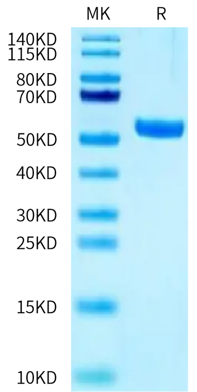 Biotinylated Human HLA-A*02:01&B2M&MAGE-A3 (KVAELVHFL) Monomer on Tris-Bis PAGE under reduced condition. The purity is greater than 95%.