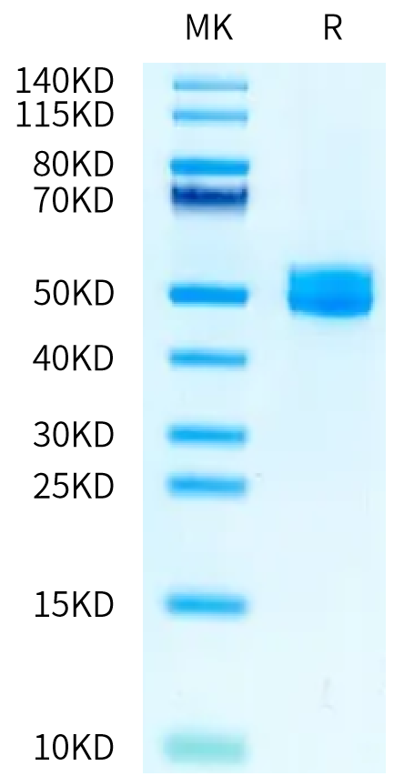 Rat IL-13Ra2 on Tris-Bis PAGE under reduced condition. The purity is greater than 95%.