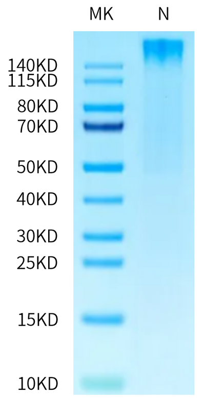 Human HLA-A*02:01&B2M&PRAME (ALYVDSLFFL) Tetramer on Tris-Bis PAGE under reduced condition. The purity is greater than 95%.