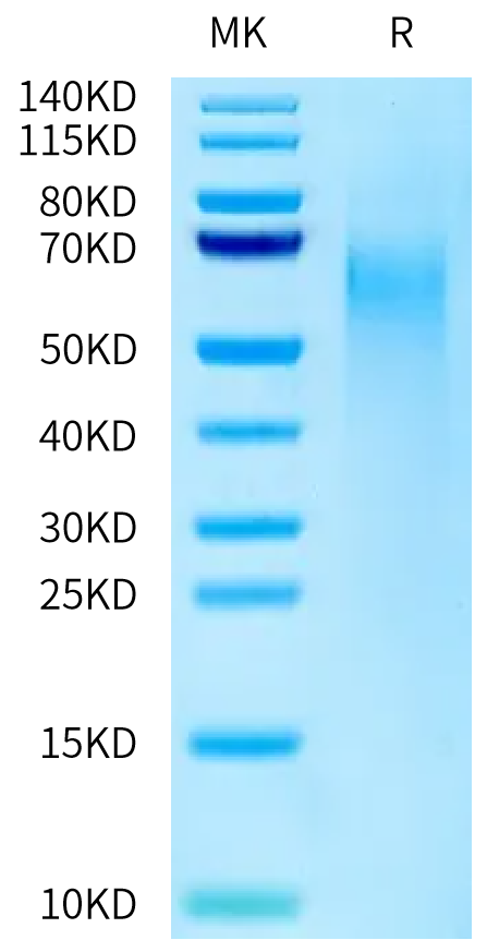 Cynomolgus CD27 Ligand on Tris-Bis PAGE under reduced condition. The purity is greater than 95%.