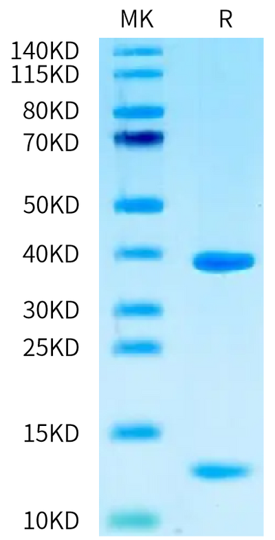 Human HLA-A*02:01&B2M&WT-1 (RMFPNAPYL) Monomer on Tris-Bis PAGE under reduced condition. The purity is greater than 95%.