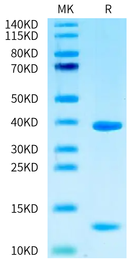 Human HLA-A*02:01&B2M&WT-1 (RMFPNAPYL) Monomer on Tris-Bis PAGE under reduced condition. The purity is greater than 95%.