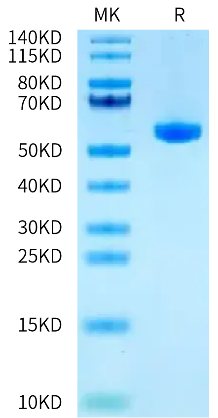 Human HLA-A*11:01&B2M&HPV16 E7 (IVCPICSQK) Monomer on Tris-Bis PAGE under reduced condition. The purity is greater than 95%.