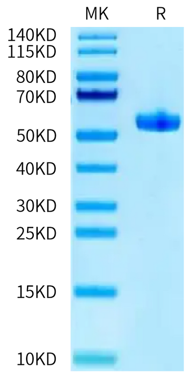 Biotinylated Human HLA-A*11:01&B2M&HPV16 E7 (IVCPICSQK) Monomer on Tris-Bis PAGE under reduced condition. The purity is greater than 95%.