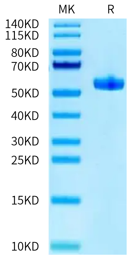 Biotinylated Human HLA-A*11:01&B2M&HPV16 E7 (IVCPICSQK) Monomer on Tris-Bis PAGE under reduced condition. The purity is greater than 95%.