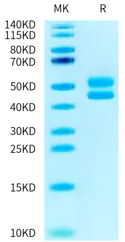 Human CD3E&CD3D on Tris-Bis PAGE under reduced condition. The purity is greater than 95%.