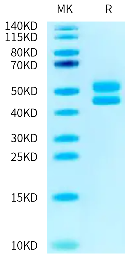 Human CD3E&CD3D on Tris-Bis PAGE under reduced condition. The purity is greater than 95%.