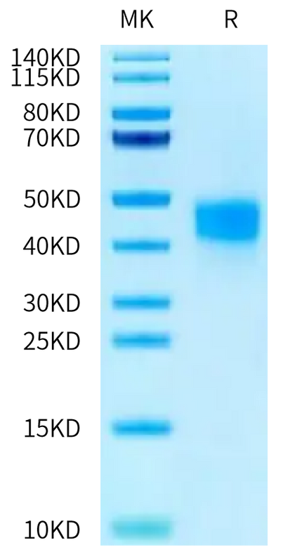 Human Fc gamma RIIIB (NA1) on Tris-Bis PAGE under reduced condition. The purity is greater than 95%.