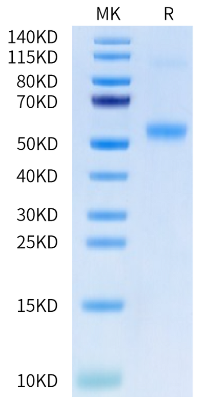 Human Galectin 9 on Tris-Bis PAGE under reduced condition. The purity is greater than 95%.