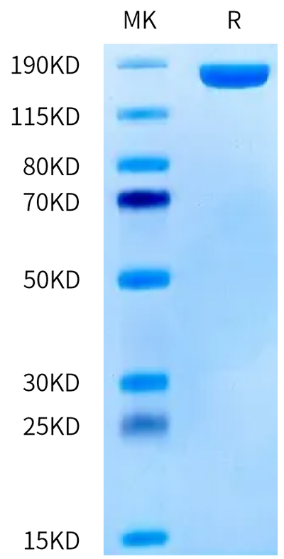 Human CD206 on Tris-Bis PAGE under reduced condition. The purity is greater than 95%.