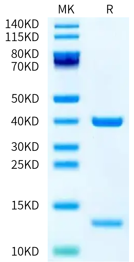 Biotinylated Human HLA-A*02:01&B2M&P53 R175H (HMTEVVRHC) Monomer on Tris-Bis PAGE under reduced condition. The purity is greater than 95%.