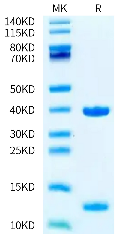 Biotinylated Human HLA-A*02:01&B2M&P53 WT (HMTEVVRRC) Monomer on Tris-Bis PAGE under reduced condition. The purity is greater than 95%.