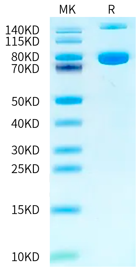 Mouse Transferrin R on Tris-Bis PAGE under reduced condition. The purity is greater than 95%.