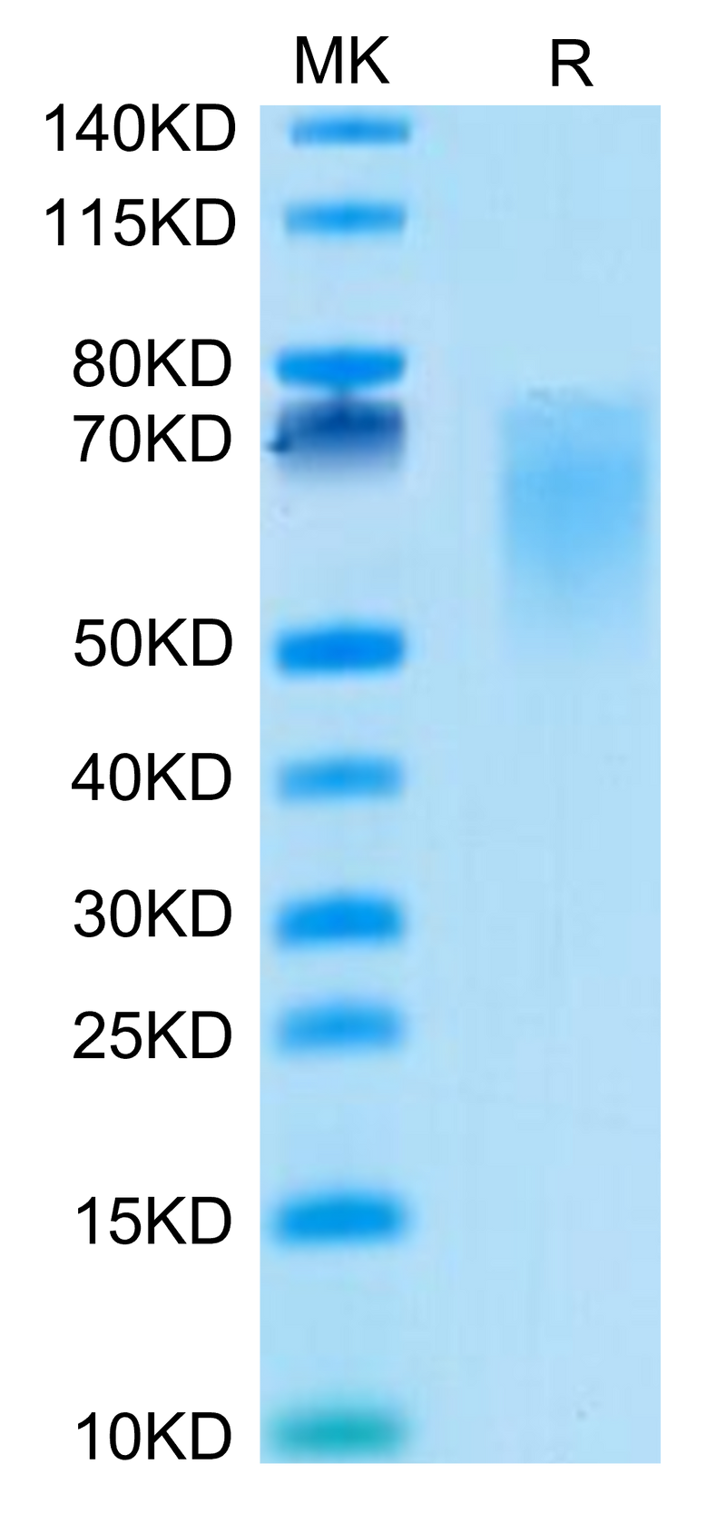 Cynomolgus B7-2 on Tris-Bis PAGE under reduced condition. The purity is greater than 95%.