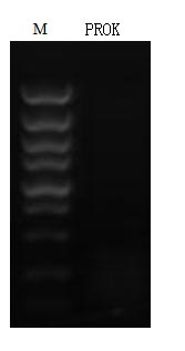 Detect Nucleic acid residue by agarose gel electrophores