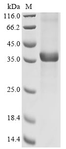 Greater than 85% as determined by SDS-PAGE.