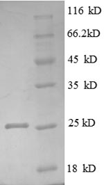 Greater than 90% as determined by SDS-PAGE.